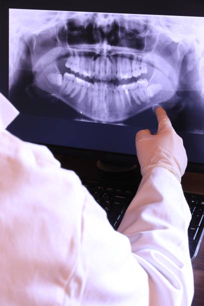 Best Emergency Wisdom Tooth Extraction in North Auburn, CA